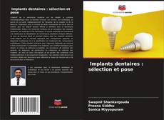 Buchcover von Implants dentaires : sélection et pose