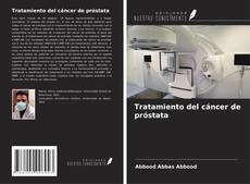 Tratamiento del cáncer de próstata kitap kapağı