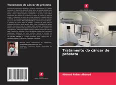 Capa do livro de Tratamento do câncer de próstata 