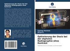 Buchcover von Optimierung der Dosis bei der digitalen Radiographie ohne Kontrast