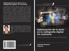 Buchcover von Optimización de la dosis en la radiografía digital sin contraste