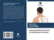 Buchcover von Lebensqualität bei Personen mit allergischer Dermatitis