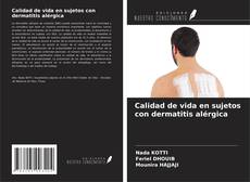 Copertina di Calidad de vida en sujetos con dermatitis alérgica