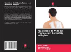 Capa do livro de Qualidade de Vida em Temas com Dermatite Alérgica 