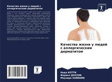 Качество жизни у людей с аллергическим дерматитом的封面