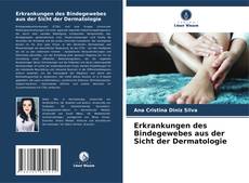 Portada del libro de Erkrankungen des Bindegewebes aus der Sicht der Dermatologie