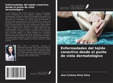 Enfermedades del tejido conectivo desde el punto de vista dermatológico kitap kapağı