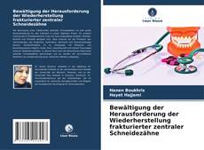 Buchcover von Bewältigung der Herausforderung der Wiederherstellung frakturierter zentraler Schneidezähne