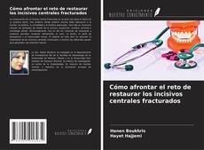 Bookcover of Cómo afrontar el reto de restaurar los incisivos centrales fracturados