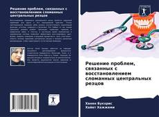 Bookcover of Решение проблем, связанных с восстановлением сломанных центральных резцов