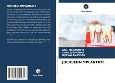 Bookcover of JOCHBEIN-IMPLANTATE