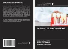 Buchcover von IMPLANTES ZIGOMÁTICOS