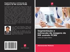 Segmentação e extracção de imagens de MR usando PCNN kitap kapağı