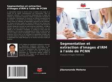 Portada del libro de Segmentation et extraction d'images d'IRM à l'aide de PCNN