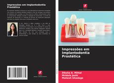 Impressões em Implantodontia Prostética的封面