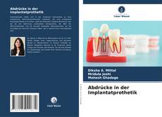 Buchcover von Abdrücke in der Implantatprothetik