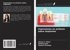 Bookcover of Impresiones en prótesis sobre implantes