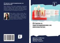 Capa do livro de Оттиски в протезировании на имплантатах 