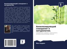 Bookcover of Анкилозирующий спондилит в натуропатии.