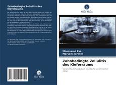 Capa do livro de Zahnbedingte Zellulitis des Kieferraums 