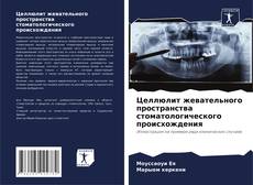 Bookcover of Целлюлит жевательного пространства стоматологического происхождения