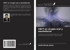 Couverture de CBCT en cirugía oral y maxilofacial