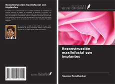 Reconstrucción maxilofacial con implantes kitap kapağı