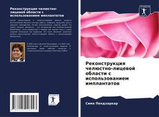 Bookcover of Реконструкция челюстно-лицевой области с использованием имплантатов
