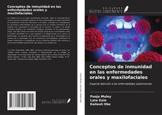 Bookcover of Conceptos de inmunidad en las enfermedades orales y maxilofaciales