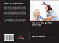 Bookcover of Imagerie des glandes salivaires