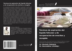 Bookcover of Técnicas de aspiración del líquido folicular y de recuperación de ovocitos y recogida