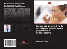 Bookcover of Fréquence de récidive de la polypose nasale après polypectomie endoscopique