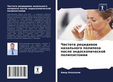 Couverture de Частота рецидивов назального полипоза после эндоскопической полипэктомии