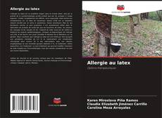 Buchcover von Allergie au latex