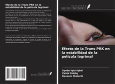 Bookcover of Efecto de la Trans PRK en la estabilidad de la película lagrimal