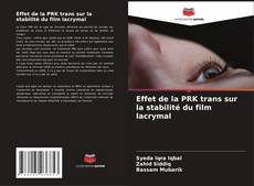 Copertina di Effet de la PRK trans sur la stabilité du film lacrymal