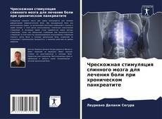 Portada del libro de Чрескожная стимуляция спинного мозга для лечения боли при хроническом панкреатите