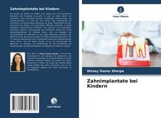 Bookcover of Zahnimplantate bei Kindern