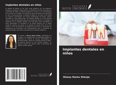 Couverture de Implantes dentales en niños