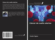 Cáncer de cuello uterino kitap kapağı