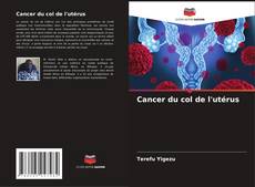 Copertina di Cancer du col de l'utérus