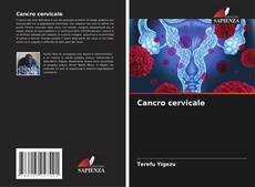 Capa do livro de Cancro cervicale 