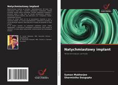 Portada del libro de Natychmiastowy implant