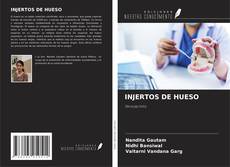 INJERTOS DE HUESO kitap kapağı