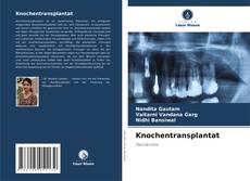 Buchcover von Knochentransplantat