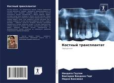 Portada del libro de Костный трансплантат