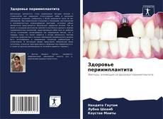 Bookcover of Здоровье периимплантита