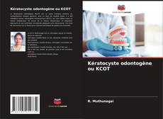 Bookcover of Kératocyste odontogène ou KCOT