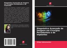 Capa do livro de Diagnóstico Avançado de Imagens em Cirurgias Periodontais e de Implantes 