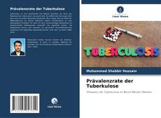 Обложка Prävalenzrate der Tuberkulose